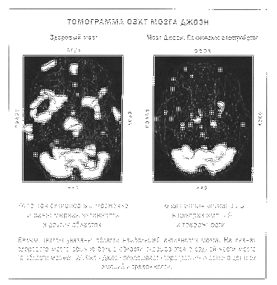 Первое изображение главного мозгового рецептора, пойманного в действии: новые изображения показывают работу фундаментального процесса, связанного с памятью, обучением и другими ключевыми функциями мозга