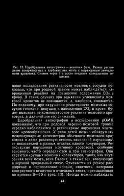 Анализ крови на черепно-мозговую травму в конце концов может оказаться невозможным