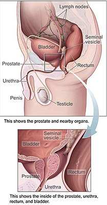 Последствия некорректных данных по специфическому антигену простаты в SEER