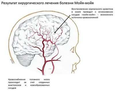 Возможный недостаток внутреннего хирургического туризма
